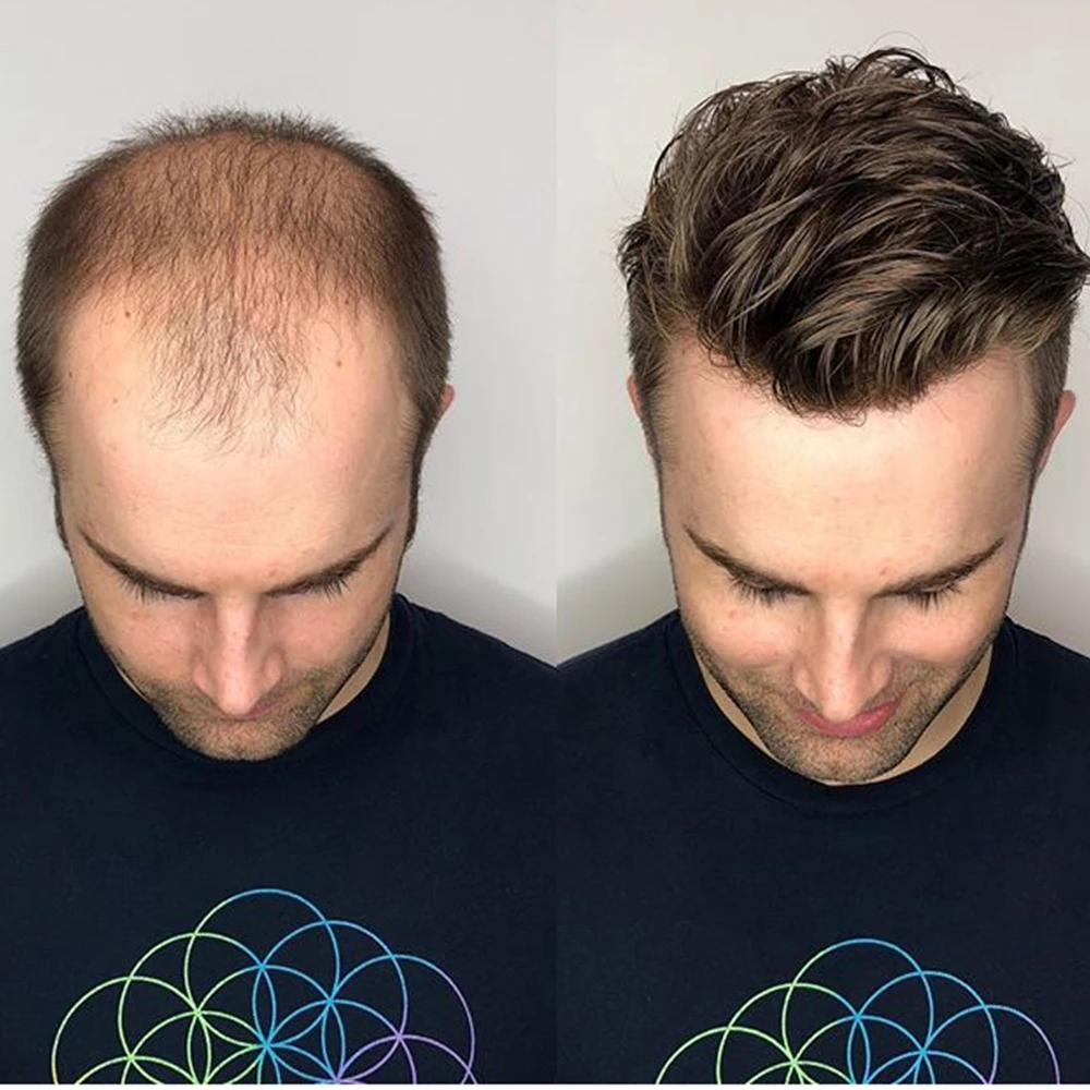 Мъжка перука от швейцарския дантела или френски дантели за мъже с избелени и малки поредици за подмяна на косата, системата за коса, мъжка перука безплатна доставка - 1